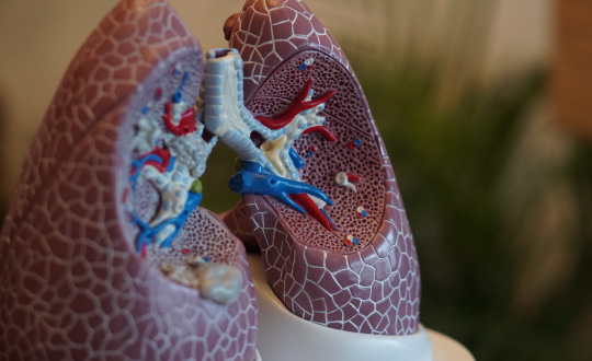 browardsleepdisorders-common-sleep-disorders-we-treat-lungs common-sleep-disorders-we-treat-lungs